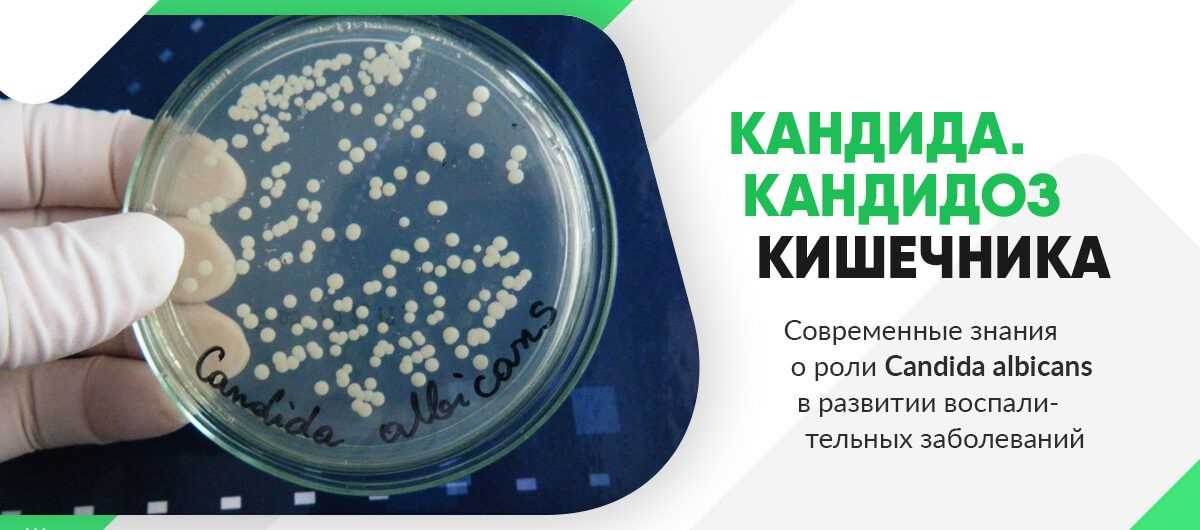 Ветрянка у детей: симптомы и лечение | ветряная оспа у детей, фото первых признаков болезни