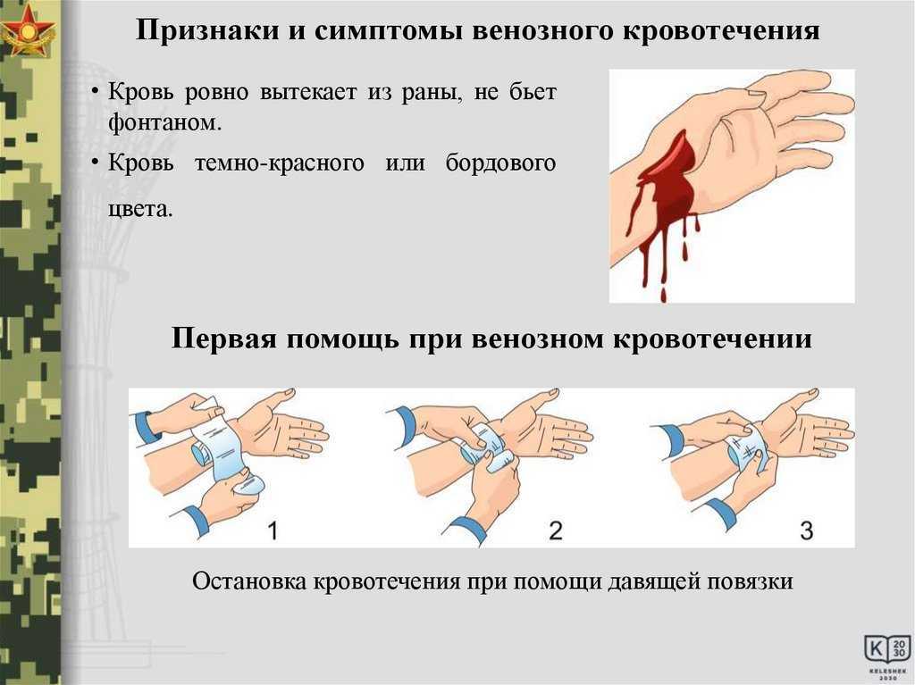 Свинушка ольховая: описание, съедобная или нет, где растет