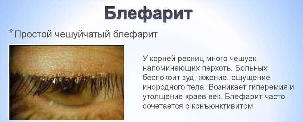 Проблемы при выращивании можжевельника и методы их решения