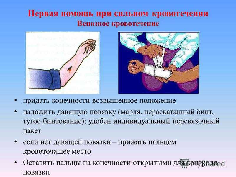 Свинушка ольховая